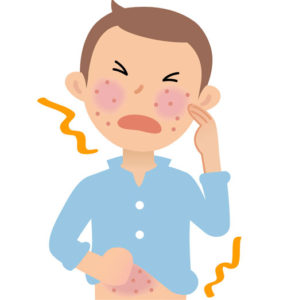 アレルギーは有害物質から体を守るために免疫力が過剰に反応して、何も異常のない細胞へ自ら攻撃をしてしまう自己免疫疾患です
