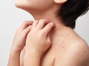 アレルギー反応は体を外敵から守る防衛反応