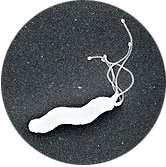 ピロリ菌は、胃の中に好んで住みつき、胃の壁を傷つける約3－5ミクロンの長さの細菌です