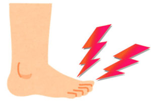 痛風になると手足の指のつけ根が痛くなることが多い