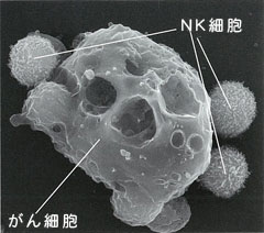 がん細胞とNK細胞