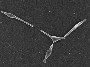 肺炎マイコプラズの電子顕微鏡写真